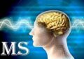 ۵۲ خدمت تشخیصی درمانی ویژه بیماران ام اس تحت پوشش بیمه سلامت
