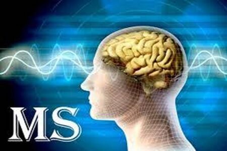 ۵۲ خدمت تشخیصی درمانی ویژه بیماران ام اس تحت پوشش بیمه سلامت